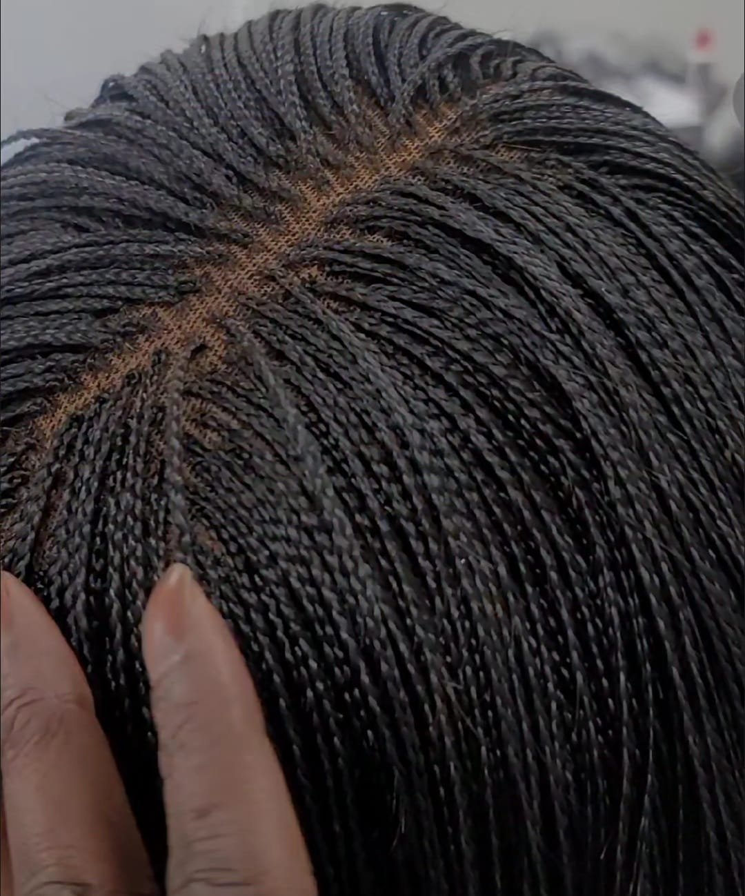 Hairline and scalp detail